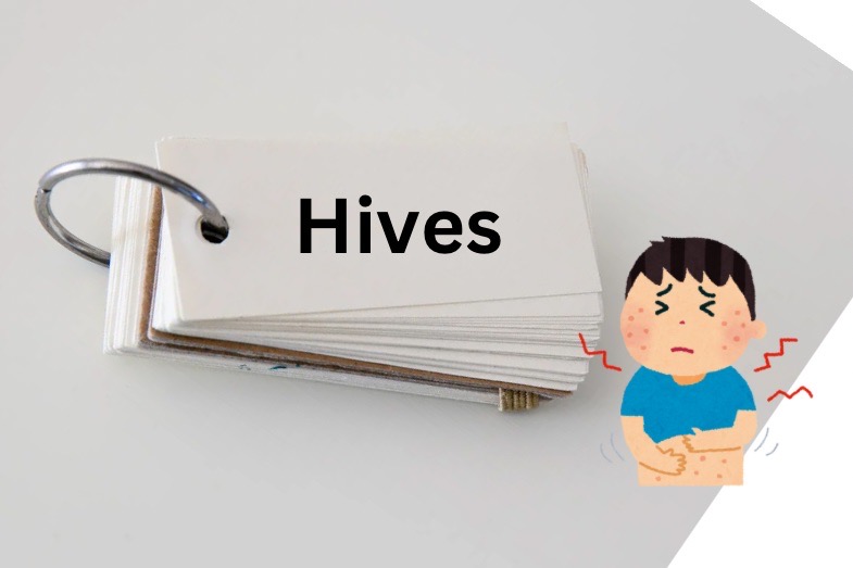 Hives　れっさー　医療英語